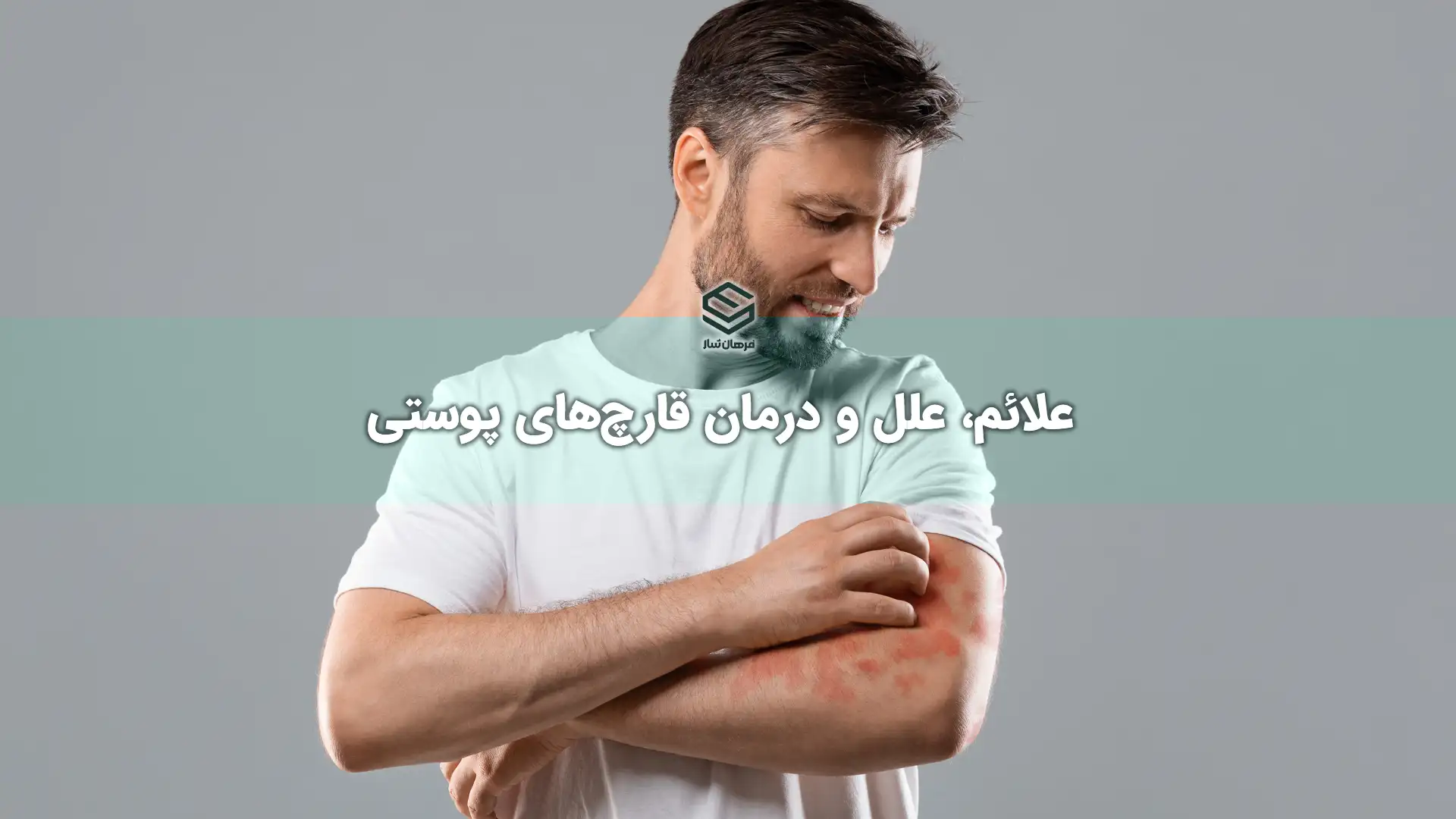 علائم، علل و درمان قارچ‌های پوستی