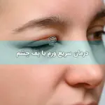 درمان سریع ورم یا پف چشم